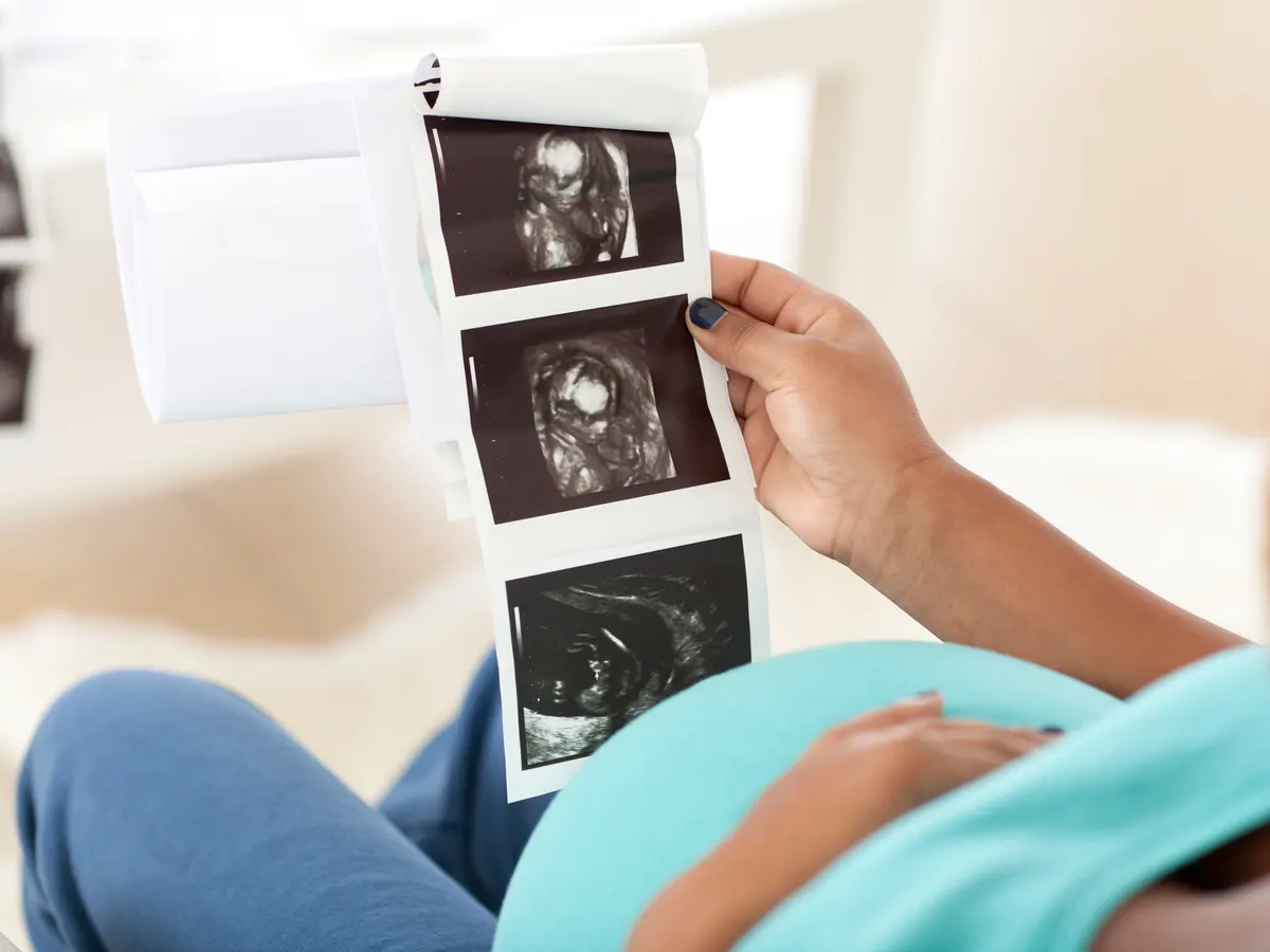 From Anxiety to Bliss: How Reassurance Baby Scans Transform Pregnancy